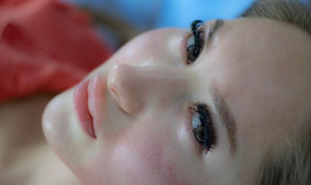 woman, skincare, facial treatment, dermatology, acne scars, skincare, skincare, facial treatment, dermatology, dermatology, dermatology, dermatology, dermatology, acne scars