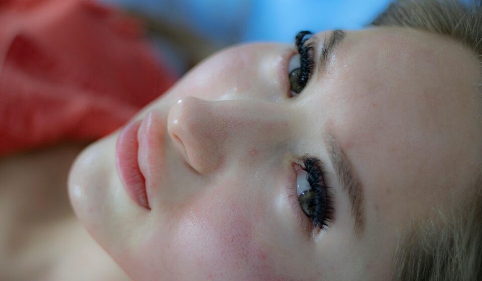 woman, skincare, facial treatment, dermatology, acne scars, skincare, skincare, facial treatment, dermatology, dermatology, dermatology, dermatology, dermatology, acne scars