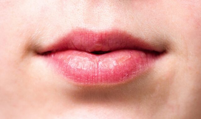 mouth, lips, dry lips, girl, smiling, woman, smile, happy, dry, face, pink, red, young, female, person, naturally, close up, macro, teenager, teen, mouth, mouth, mouth, lips, lips, lips, lips, dry lips, dry lips, dry lips, dry lips, dry lips
